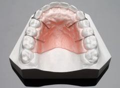 metal retainer